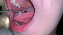 【閲覧注意】顔出しNG裏垢女子の舌苔採取したら臭いの原因が取れまくったｗ　なほ