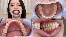 【치 페티쉬】6년만 2회째! 교정 완료한 미사키 칸나씨의 치아를 관찰했습니다!