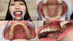 [Tooth Fetish] I observed Kurumi Tamaki&#39;s teeth!