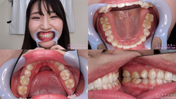 [Tooth Fetish] I observed Mako Shion&#39;s teeth!