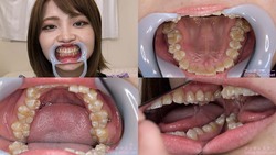 [Tooth fetish] I observed Rui Onkoto&#39;s teeth!