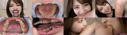 [With 3 bonus videos] Rui Onkoto&#39;s teeth and bite series 1-2 collectively DL