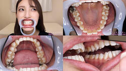 【치아 페티쉬】모리자와 카나의 이빨을 관찰했습니다!