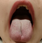 [打折进行中！！] [素人无经验] 用口气检查器确认23岁胖嘴唇女人口臭的原因并闻到主观口臭[结果如何？]