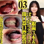 Apparel clerk Misaki&#39;s 3 silver teeth &amp; a gaping space Opening device Oral appreciation