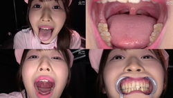 【치아・구내】미인 간호사 츠키노 코하루 장의 혀 벨로・치아・구내・목구멍 관찰♬