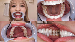[戀牙]我觀察了Noa Eikawa的牙齒！
