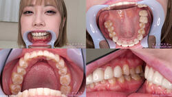 【치아 페티쉬】카와나 미스즈의 치아를 관찰했습니다!