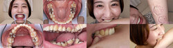 [With 5 bonus videos] Sakikazu Sasaki&#39;s Teeth and Biting Series 1-2 Collectively DL