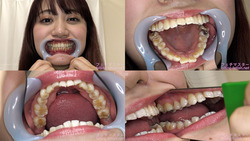 [Tooth fetish] I observed Yukino Nagasawa&#39;s teeth!