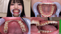 【치아 페티쉬】 스즈네 안나 짱의 치아를 관찰했습니다!