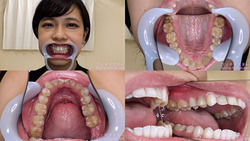 [Tooth fetish] I observed Fuuka Nagano&#39;s teeth!