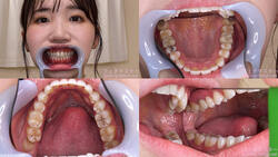 【戀牙癖】我觀察了弘前綾香的牙齒！