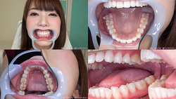 We observed the teeth [dental Fetish: Hatano YUI-CHAN! [Permanent]