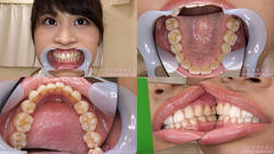 【치아 페티쉬】나코 쿠리리의 이빨을 관찰했습니다!