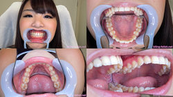 【歯フェチ】河音くるみちゃんの歯を観察しました！